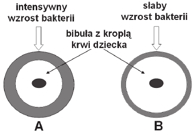 Test na fenyloketonurię